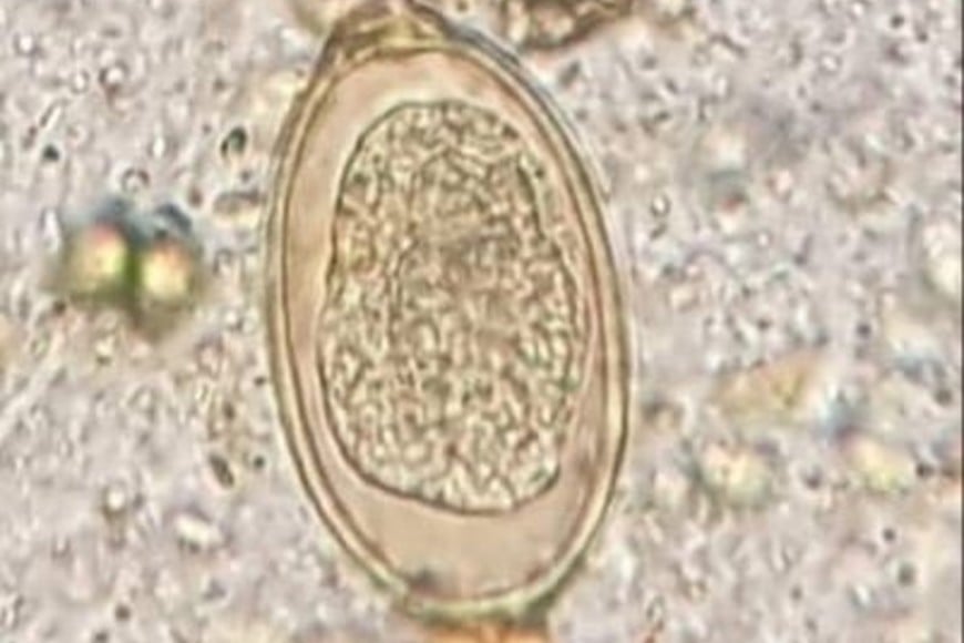 parasito