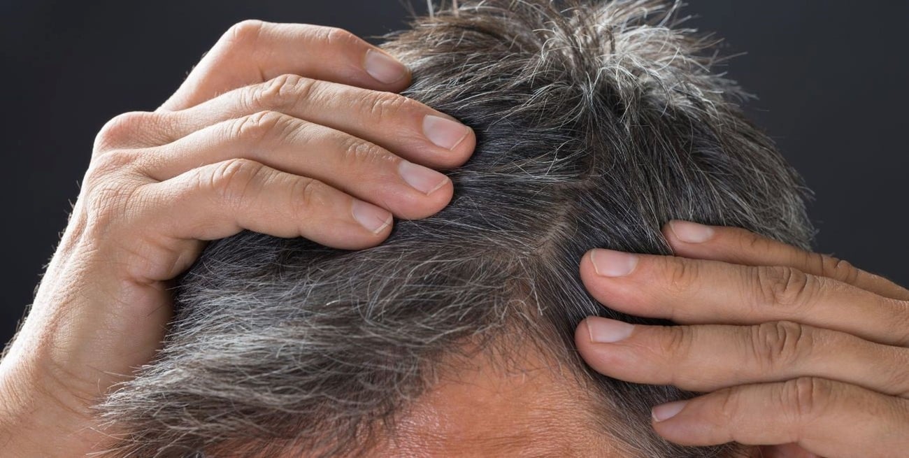 Las primeras canas suelen aparecer entre los 30 y 50 años.