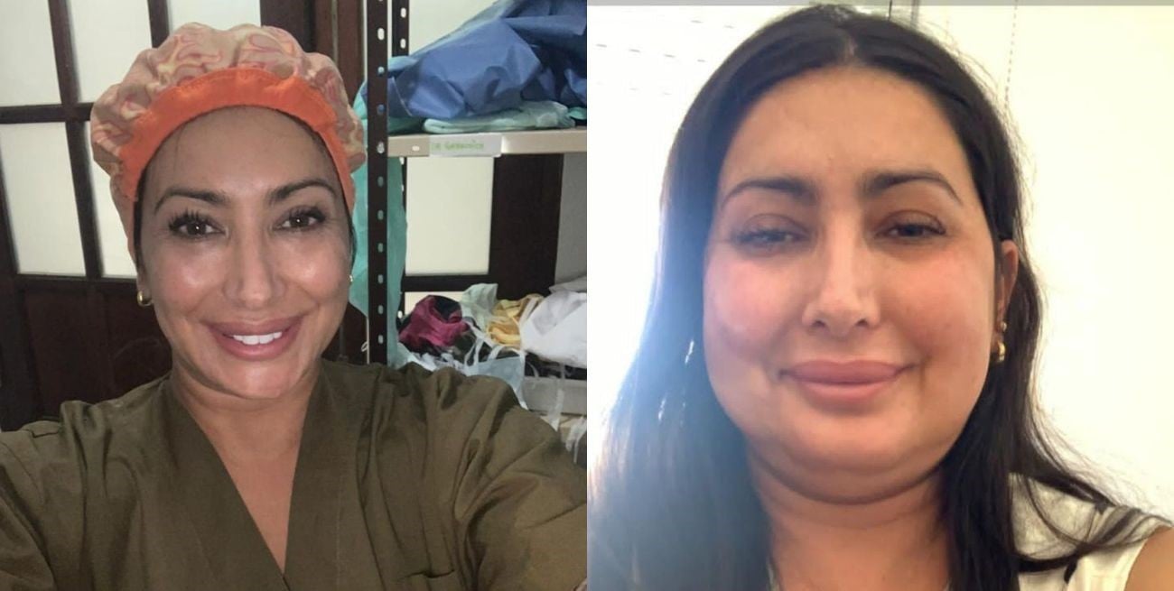 María Laura compartió sus fotos con el “antes” y el “después” de una seguidilla de cirugías estéticas.
