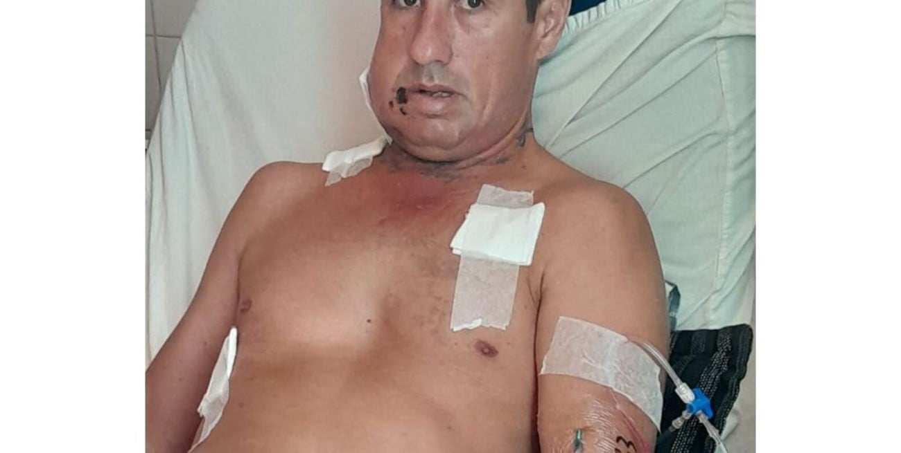Matías Gamboa (41) sobrevivió a tres impactos de bala en zonas vitales. Foto: Gentileza