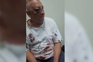 Omar llegó a la comisaría de Arroyo Leyes bañado en sangre por los golpes sufridos.