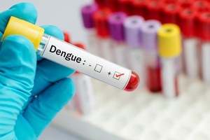 El dengue, que en la mayor parte de Colombia es endémico y se transmite por la hembra del mosquito Aedes Aegypti, puede evolucionar en un cuadro potencialmente mortal llamado dengue grave o dengue hemorrágico.