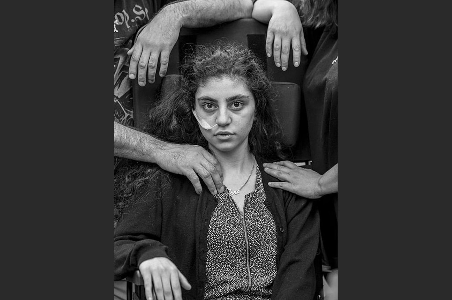 Una joven armenia se recupera del Síndrome de Resignación