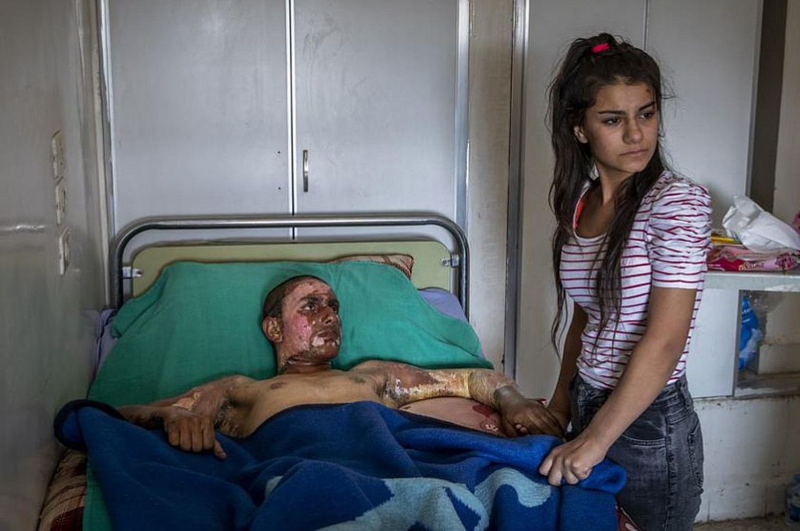 Ahmed Ibrahim, un combatiente del SDF de apenas 18 años que quedó gravemente quemado, y a su novia en un hospital en Siria