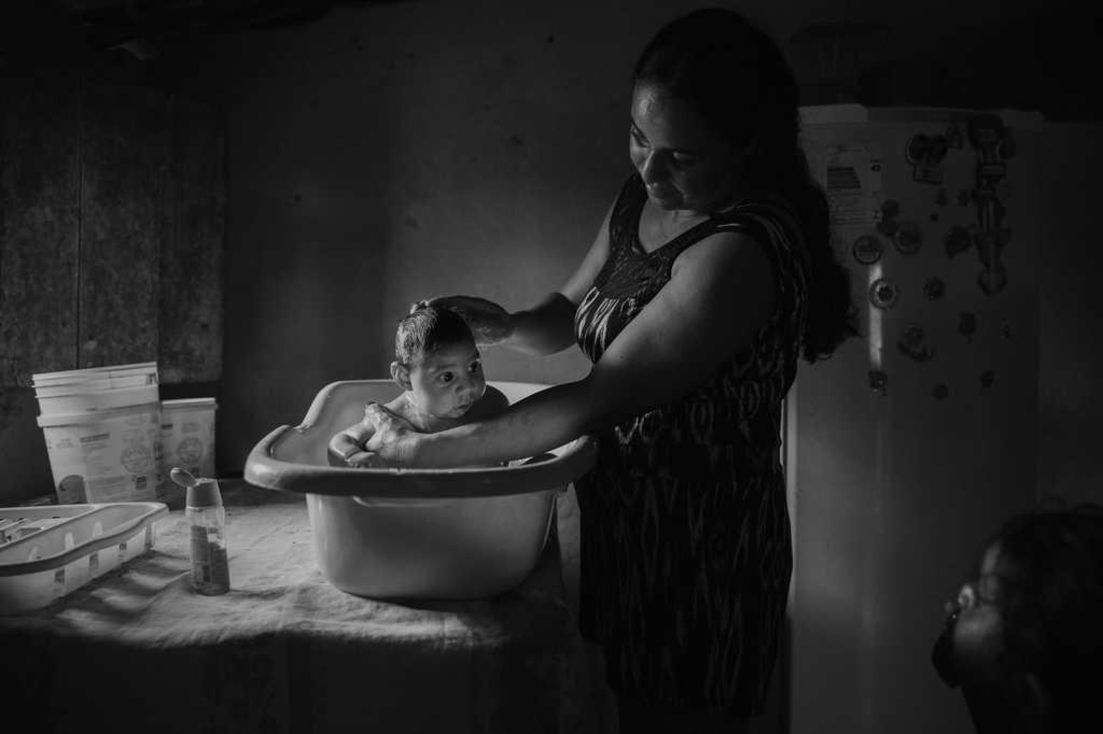 Una mujer de 30 años le da un baño a su bebé de tres meses el 20/10/2016 en Sao Vicente do Seridó, Brasil. El niño nació con microcefalia a raíz del virus del Zika. La foto de Lalo de Almeida para Folha Sao Paulo fue premiada por la fundación World Press Photo.