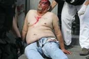 ELLITORAL_3865 |  DyN Uno de los heridos, tras los enfrentamientos con la policía