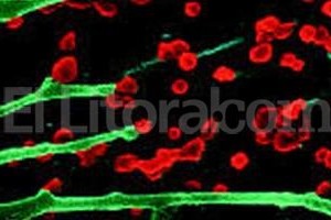 agencia DPA Casos de chikungunya se han detectado en las islas caribeñas de Haití, República Dominicana, Martinica, Guadalupe y Cuba. En América Central ya se han reportado casos en Panamá, El Salvador y la vecina Costa Rica.