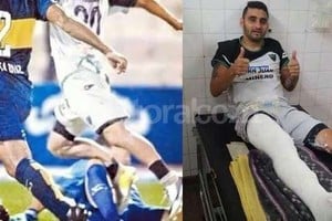 El Litoral El momento de la lesión y una vez en la clínica.