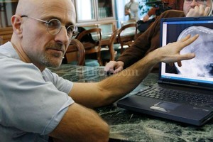 Internet El médico italiano que cree poder realizar un transplante de esas características