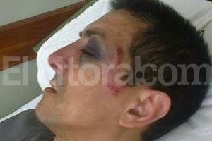 ELLITORAL_111895 | El Litoral Walter Castro está postrado en una camilla del Cullen desde hace más de una semana. Los médicos dicen que puedo perder un riñón , asegura.