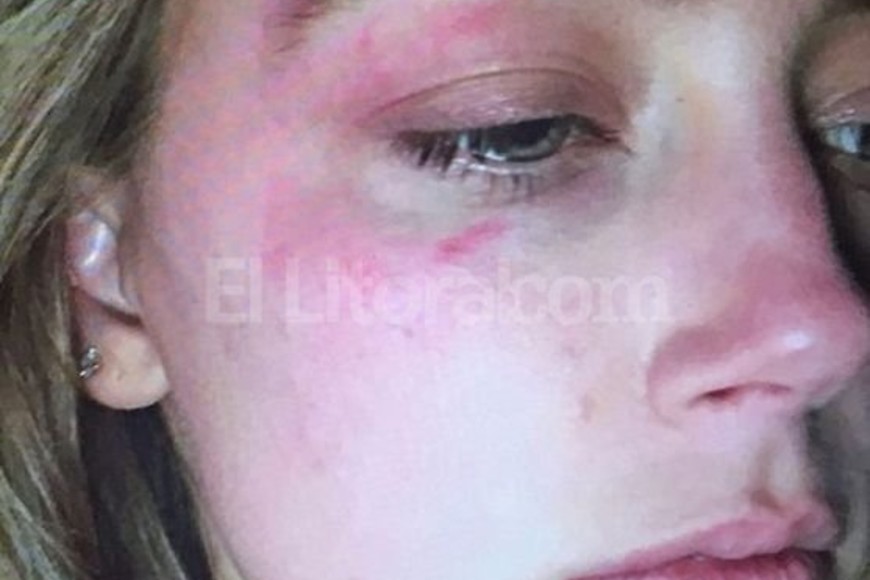 ELLITORAL_152873 |  www.losandes.com.ar