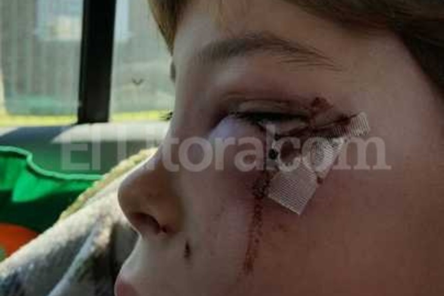ELLITORAL_164963 |  El Litoral Afortunadamente, la pequeña se recupera de las graves lesiones que sufrió en el rostro.