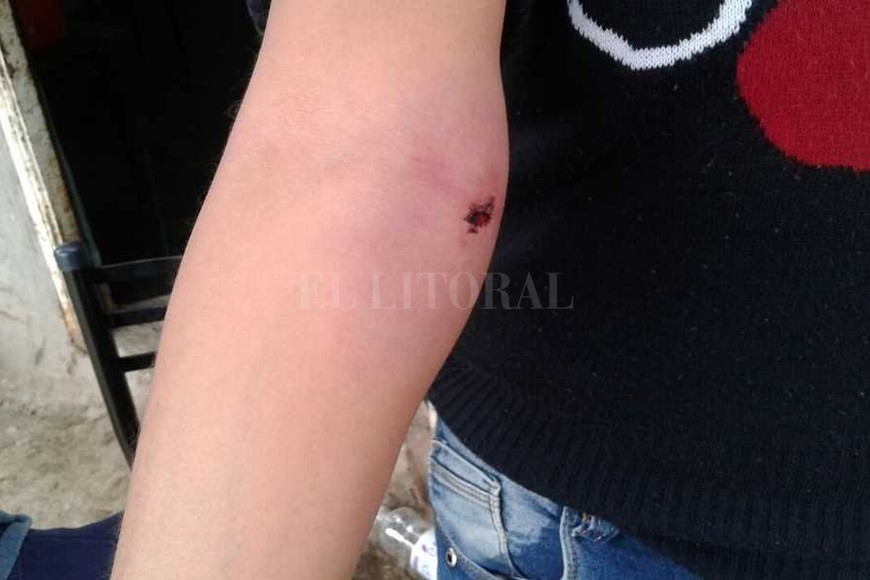 ELLITORAL_189700 | Danilo Chiapello Además de terminar con la vida de Merlo, los disparos hirieron a su sobrina que iba dentro de la Chevrolet Meriva.