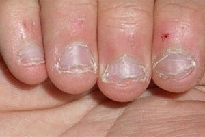 ELLITORAL_210272 |  Captura digital