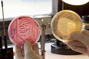 Archivo. a bacteria Escherichia coli es una de las que ha desarrollado resistencia a antibióticos. Aquí se analizan muestras de vegetales que pueden contenerla.