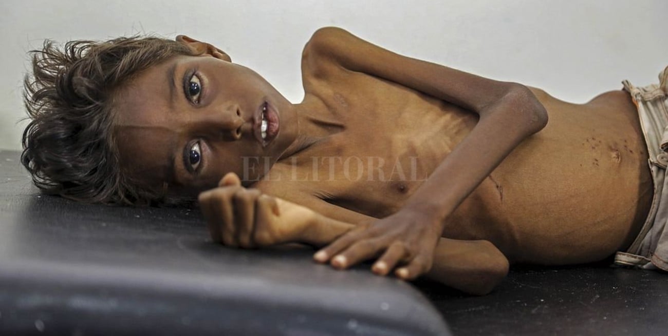 En Yemen, cada diez minutos muere un niño 