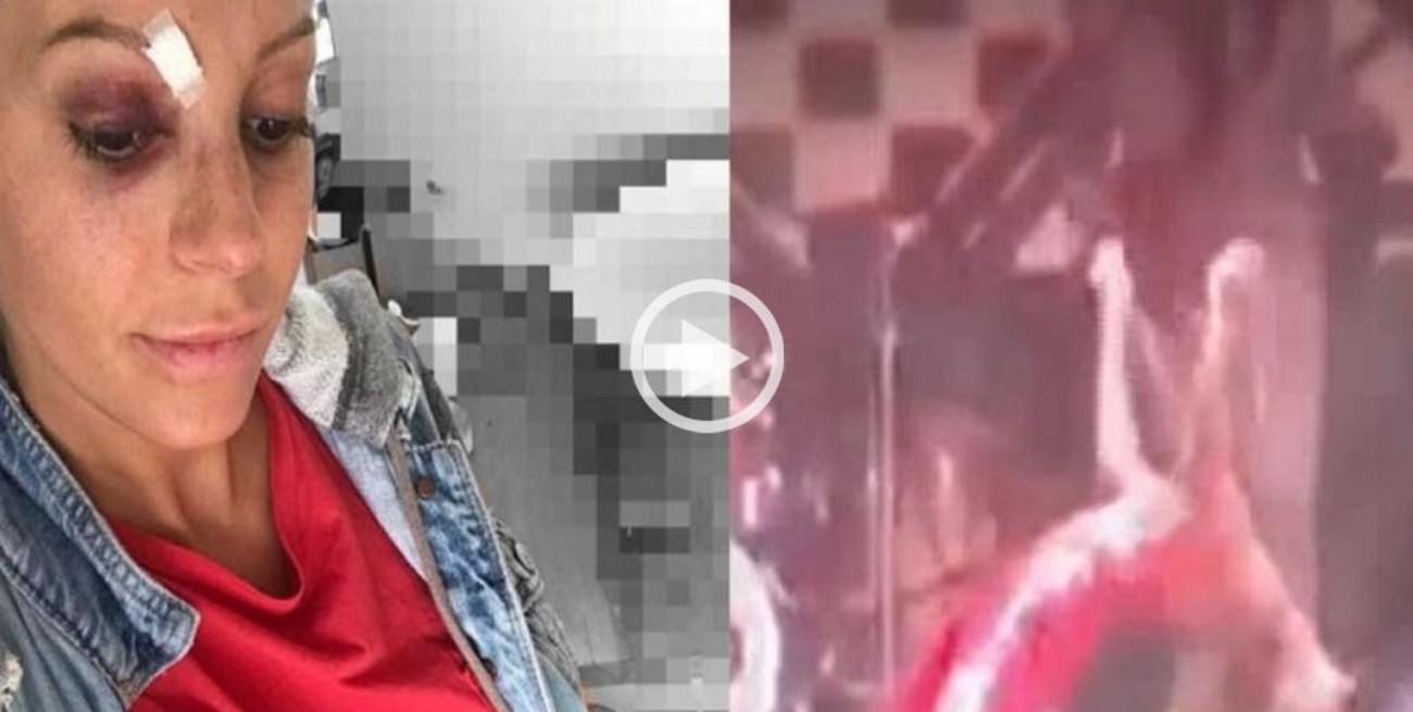 Video: el fuerte golpe de Noelia Marzol en plena función