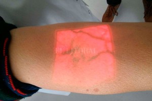 ELLITORAL_216619 |  Prensa Gobierno El visualizador funciona con un haz infrarrojo que permite detectar la hemoglobina de los glóbulos rojos.