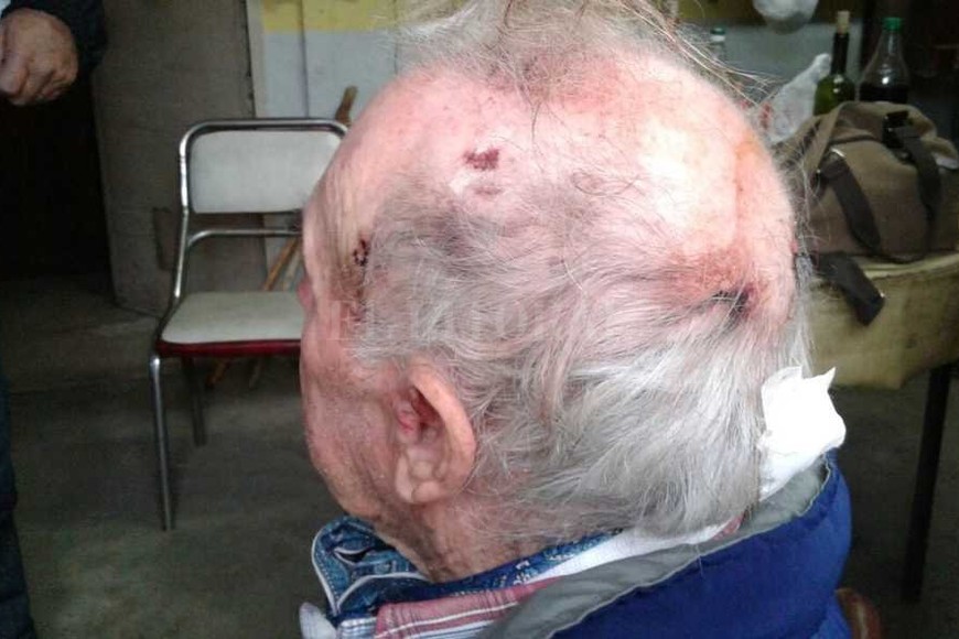 ELLITORAL_178518 |  Danilo Chiapello La víctima sufrió golpes en el rostro y una herida cortante en el cuero cabelludo.