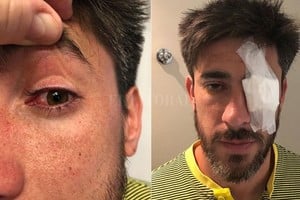 ELLITORAL_230634 |  NA Pablo Pérez sufrió una lesión ocular que lo marginó del partido.