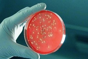ELLITORAL_223366 |  Gentileza Instituto Malbrán Los expertos del Malbrán continuarán los estudios para investigar si hay algún cambio genético en la bacteria, pero lo que detectaron hasta ahora es un  clon  que ya circulaba en el país.