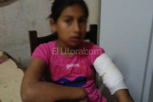 ELLITORAL_162076 |  Danilo Chiapello Zamira Gomez tiene diez años. El jueves a la noche recibió el impacto de una bala que le atravesó el brazo izquierdo.