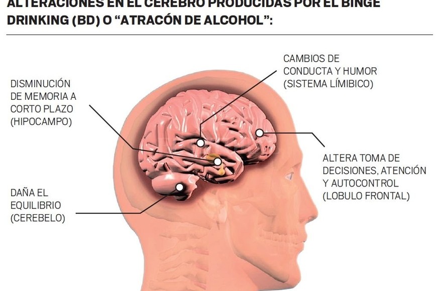 ELLITORAL_222978 |   Alcohol-atracón.