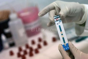 ELLITORAL_167406 |  Archivo El Litoral La naturalización del test de VIH es importante para el diagnóstico temprano, que evita el desarrollo de enfermedades marcadoras.