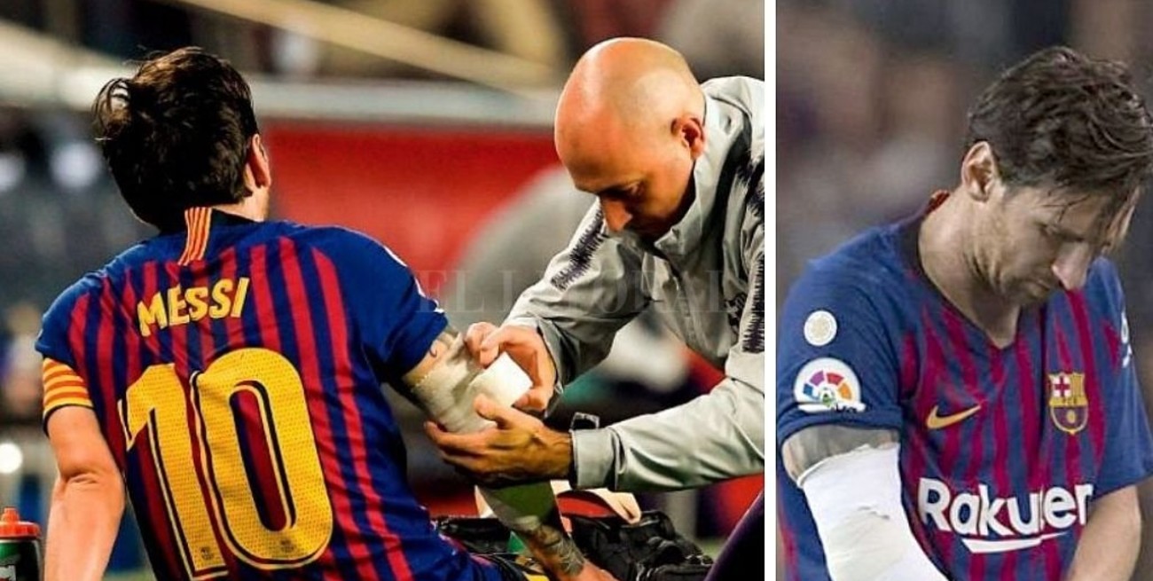 Messi se fracturó un brazo