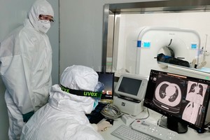 ELLITORAL_284873 |  Xinhua Doctores revisan la tomografía computarizada de los pulmones de un paciente en el Hospital Leishenshan (Montaña del Dios del Trueno) en Wuhan, capital de la provincia de Hubei, en el centro de China, el 9 de febrero de 2020. Con aproximadamente 1500 camas, el recién construido Hospital Leishenshan en Wuham.