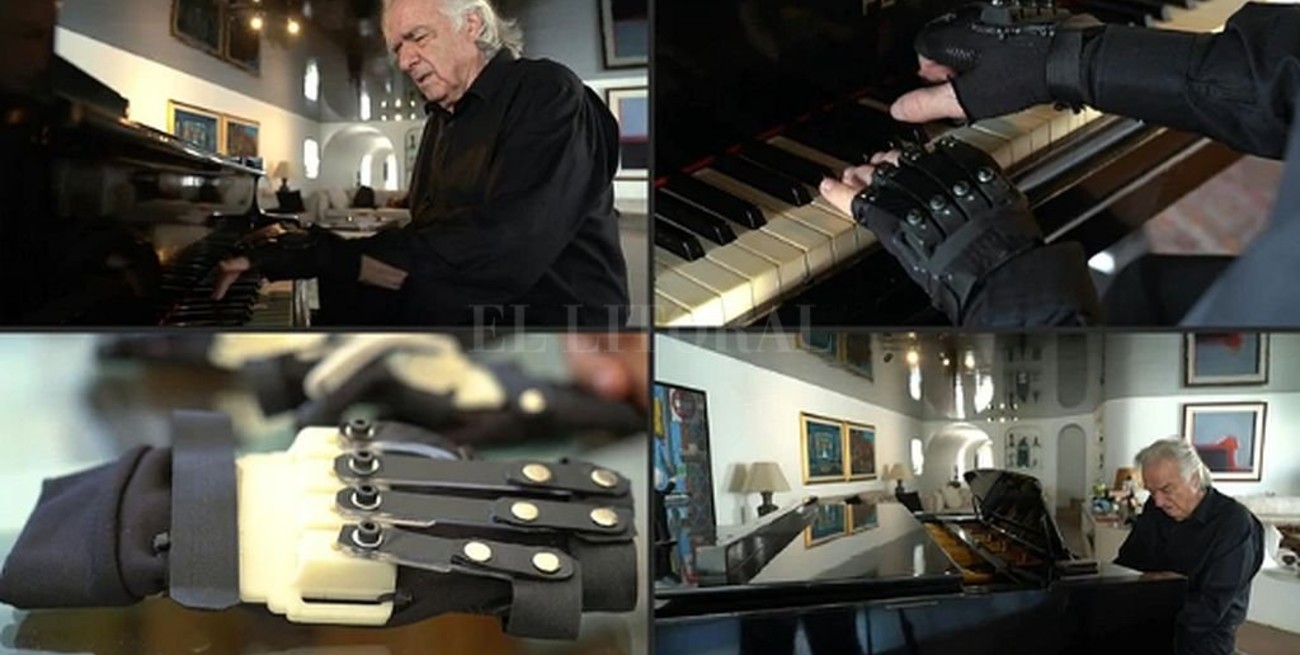 Joao Carlos Martins vuelve a tocar el piano gracias a unos guantes "biónicos"