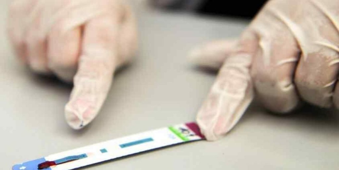 La OMS pide que incluyan "3 pruebas reactivas consecutivas" para detectar VIH