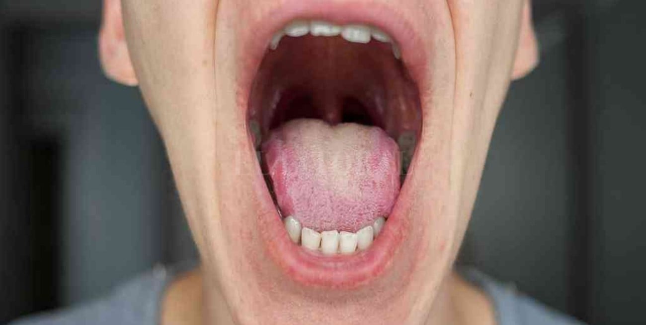 Impulsan campaña de autodetección de cáncer de boca via redes sociales