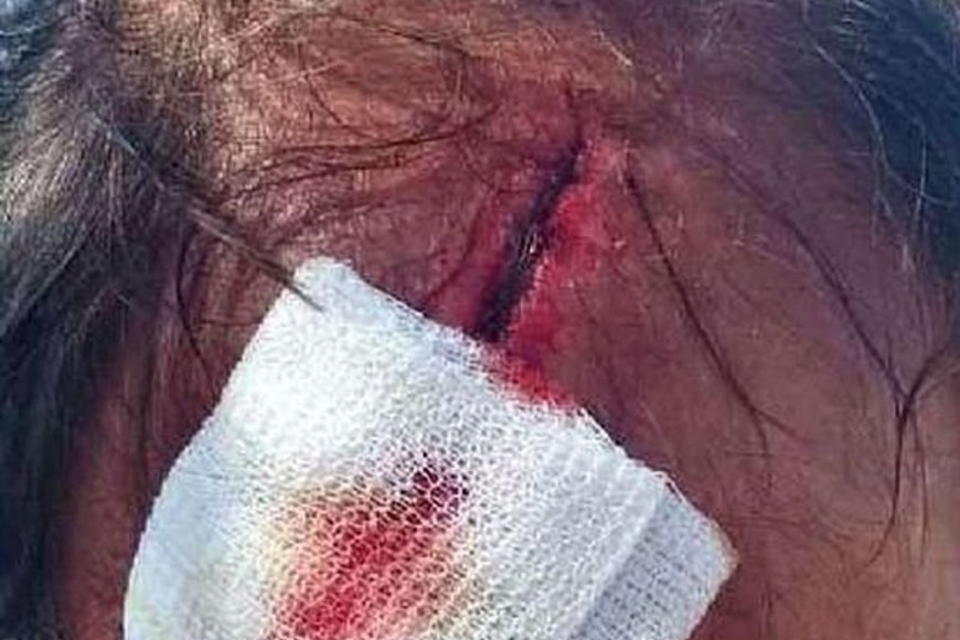 ELLITORAL_397359 |  Captura de pantalla La víctima, un comerciante de 60 años, recibió sutura en la herida