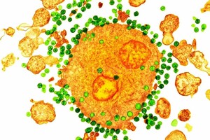 Gentileza Una micrografía electrónica de transmisión coloreada del H.I.V. Virus, en verde, unido a un glóbulo blanco, en naranja.