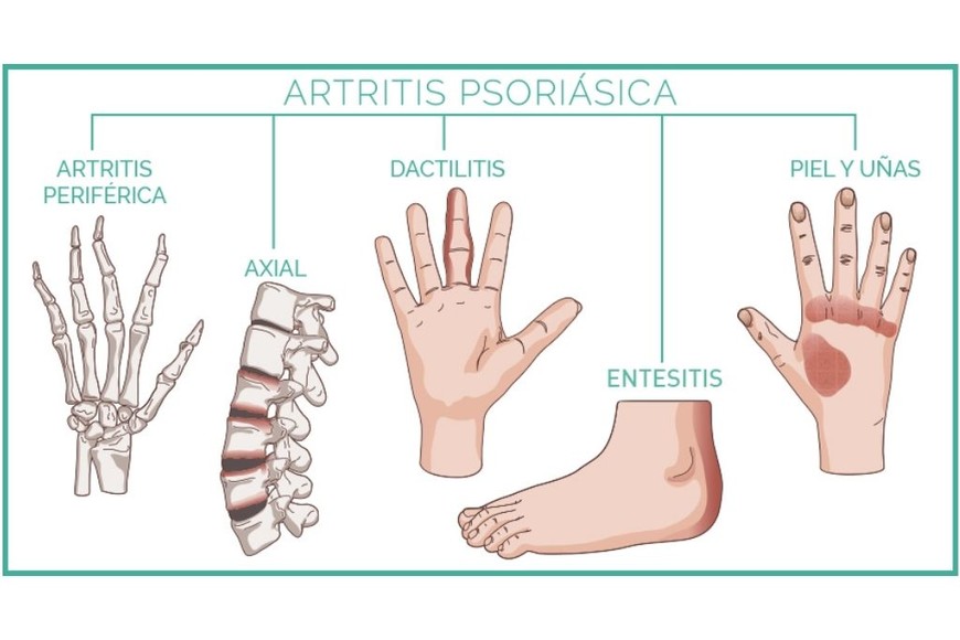 ELLITORAL_402023 |  Gentileza