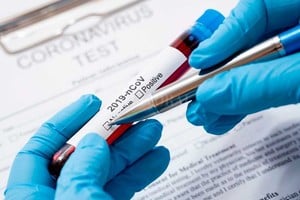 Archivo El Litoral Las muestras que están realizando se procesan prácticamente en un lapso de 24 horas. Lo incierto de la situación, preocupa a los responsables.