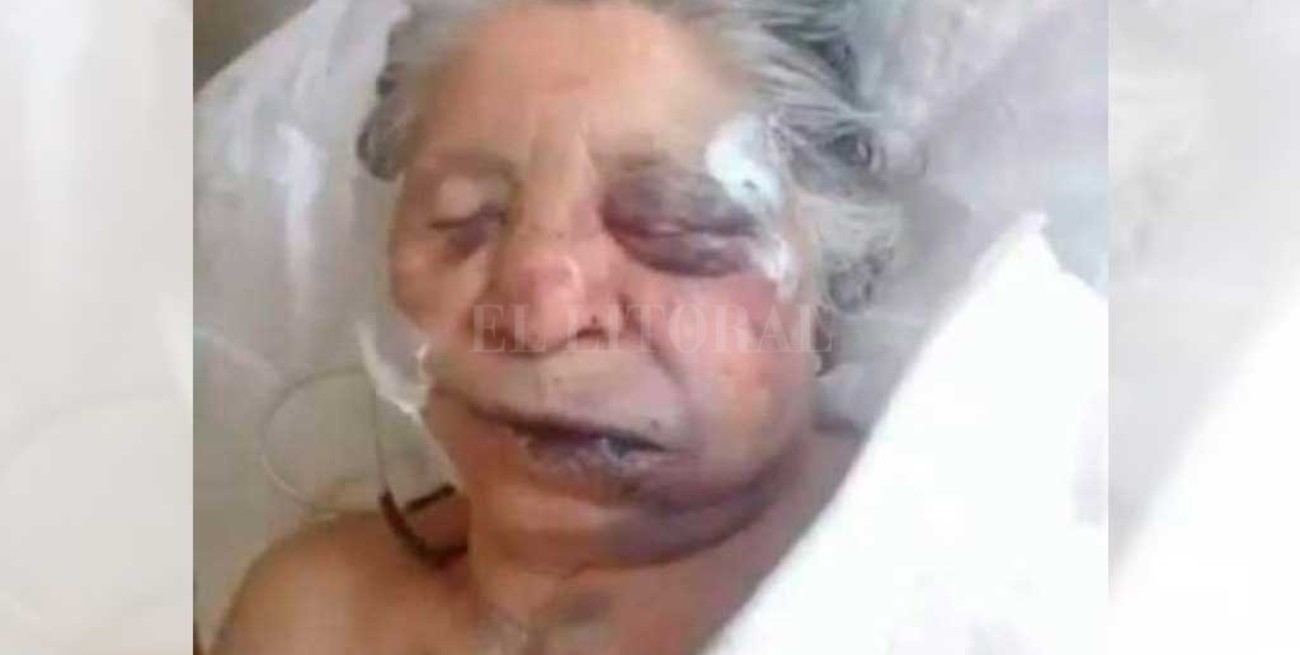 Entradera: brutal golpiza a  una anciana en Reconquista 