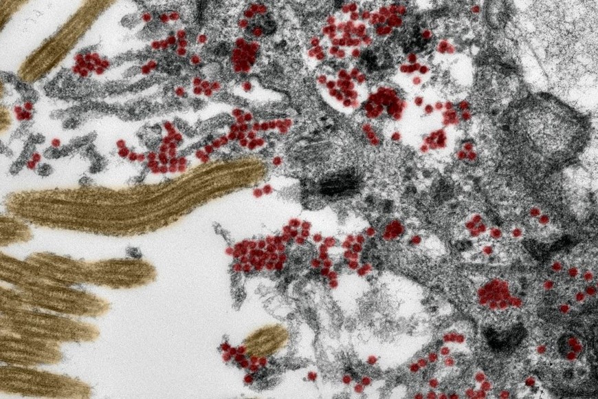 ELLITORAL_341567 |  Charité Sección de una célula de la mucosa olfativa vista al microscopio electrónico se observan en rojo las partículas del coronavirus (el color no es real).