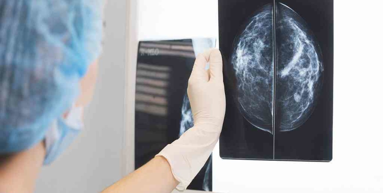 Cáncer de mama: durante la pandemia, 7 de cada 10 mujeres no hicieron la visita médica