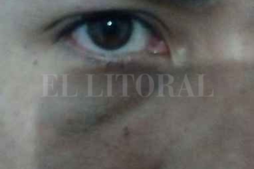 ELLITORAL_240517 |  Danilo Chiapello El colectivero resultó lesionado en uno de sus ojos y estuvo 48 hs. sin poder trabajar