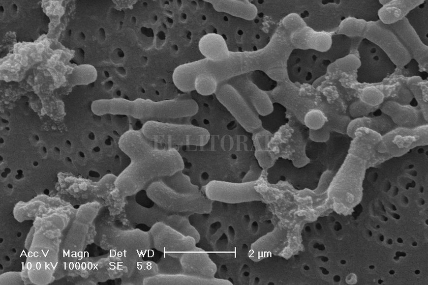 ELLITORAL_209549 |  Prensa Conicet Santa Fe. Microscopio. Mediante una investigación, lograron aislar de leche materna una cepa del género Bifidobacterium, que posee propiedades anti-inflamatorias intestinales.