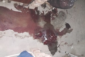 ELLITORAL_429531 |  Gentileza Los rastros de sangre de la mujer de 77 años que fue atacada en su propio domicilio.
