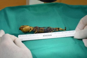 ELLITORAL_206897 |  BBC Mundo Confundieron al esqueleto de una niña recién nacida con un extraterrestre.