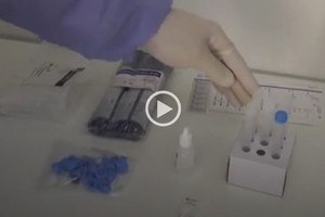 Captura de video