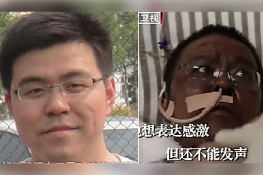 ELLITORAL_297403 |  Gentileza Así fue el cambio en la tez del Dr. Hu Weifeng.