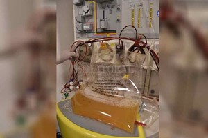 Flavio Raina Un insumo crítico para atender personas con Covid-19 en estado grave: el plasma