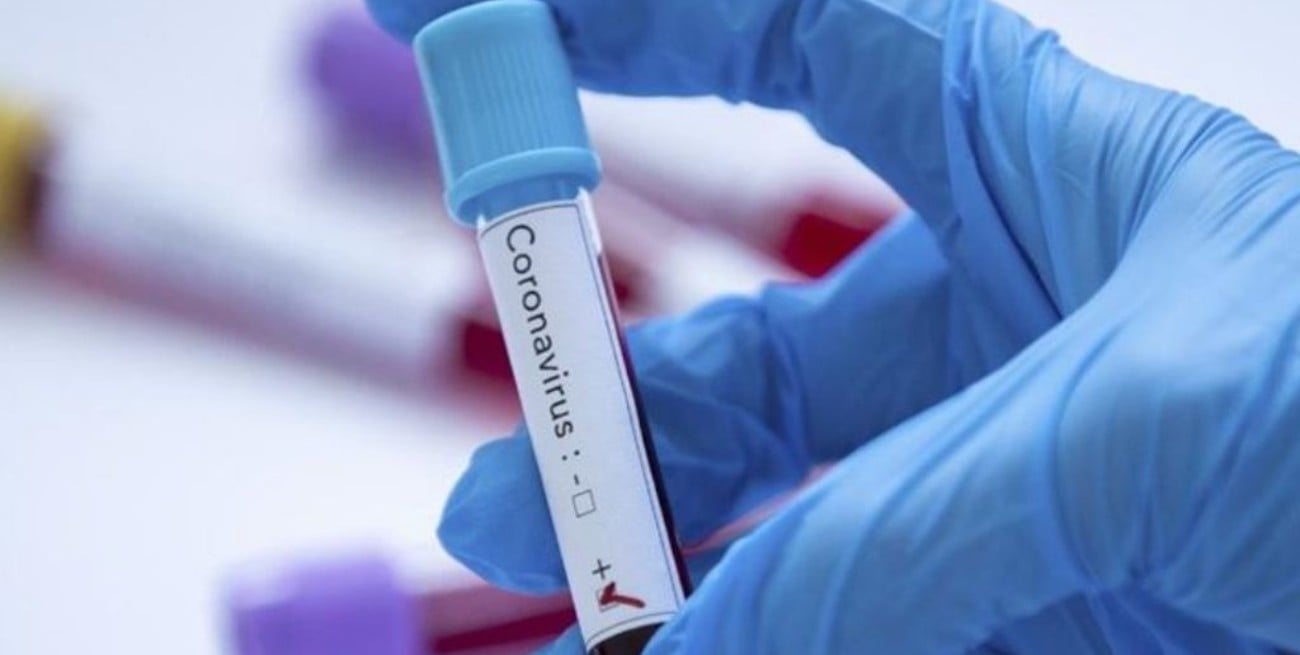 Irán anunció que empezó a producir kits de diagnóstico rápido de coronavirus