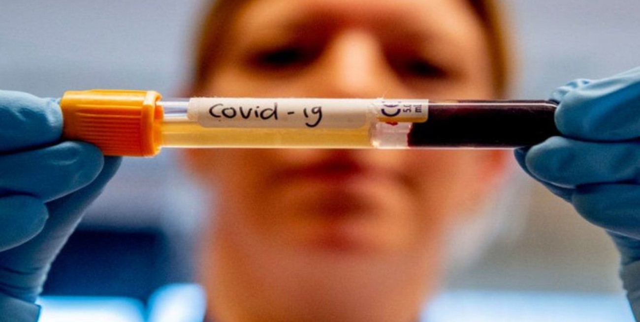 Registraron este martes 23 nuevas muertes por coronavirus en Argentina