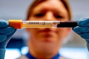 ELLITORAL_313457 |  Archivo Imagen ilustrativa.